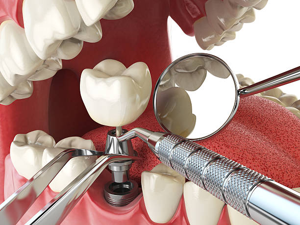 Best Emergency Gum Treatment in Anderson, MO