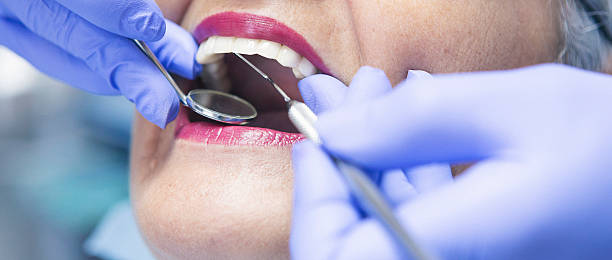 Best Emergency Treatment for Dental Infections or Abscesses in Anderson, MO