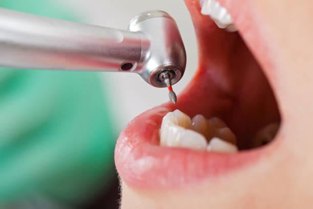 Best Emergency TMJ Treatment in Anderson, MO